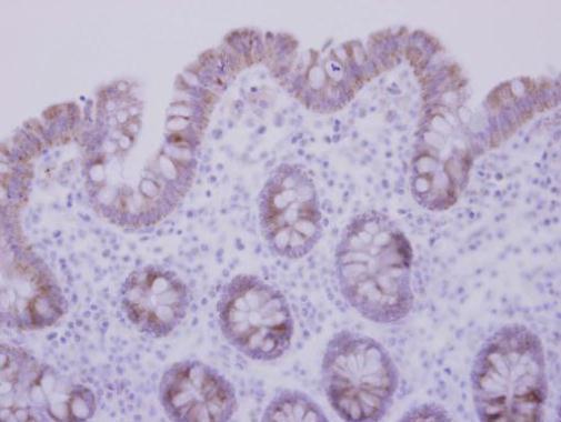 CCDC83 Rabbit Polyclonal Antibody