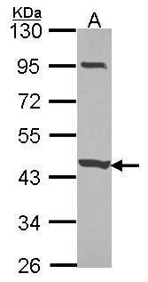 CCDC83 Rabbit Polyclonal Antibody