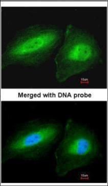 CCDC83 Rabbit Polyclonal Antibody