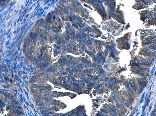 CCDC83 Rabbit Polyclonal Antibody