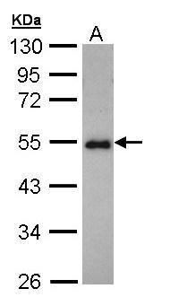 CCDC83 Rabbit Polyclonal Antibody