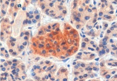 CCKBR Antibody