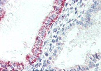 CCKBR Antibody