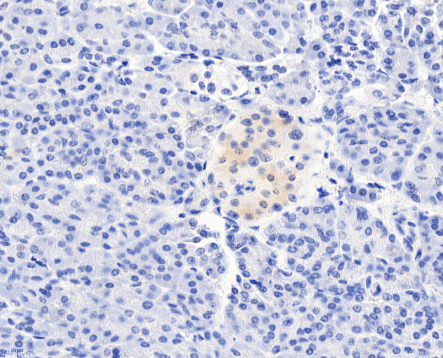 CCKBR Antibody