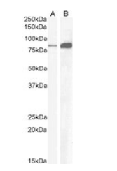 CCKBR Antibody