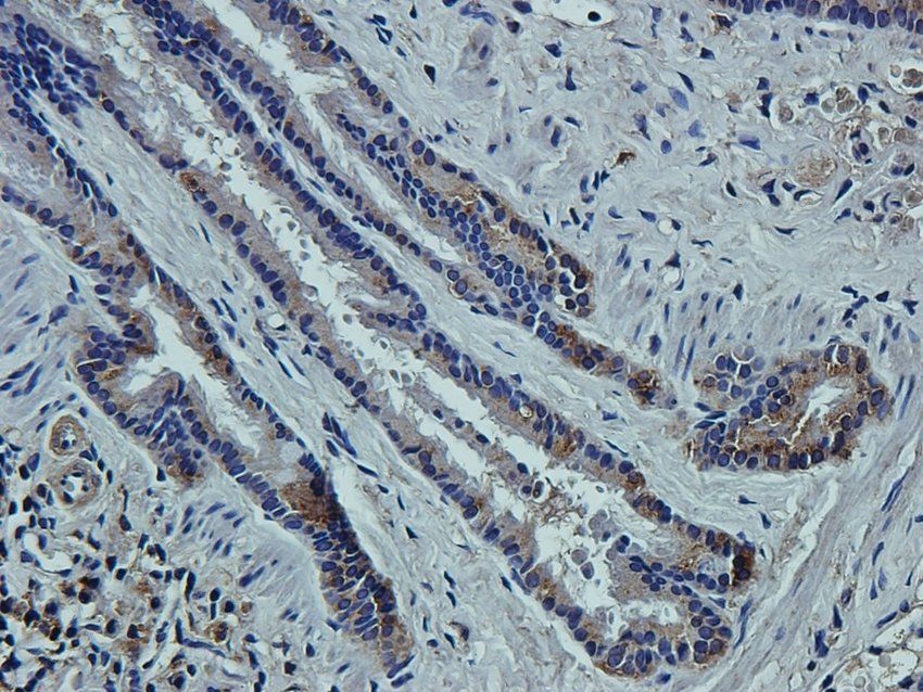 CCKN antibody