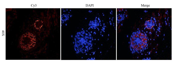 MCP1 antibody