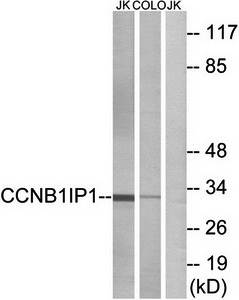 CCNB1IP1 Antibody