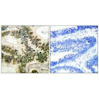 CCNE1 Antibody