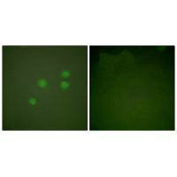 CCNE1 Antibody