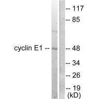 CCNE1 Antibody