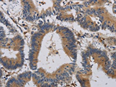 CCR2 Antibody