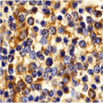 CCR3 Antibody