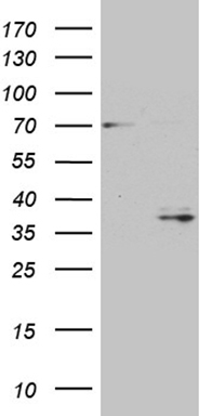 CDK20 Antibody