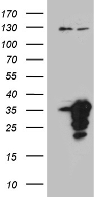 CDK20 Antibody