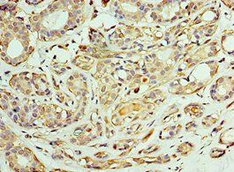 CCT6A Antibody