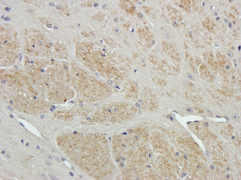 CD105 Rabbit Polyclonal Antibody