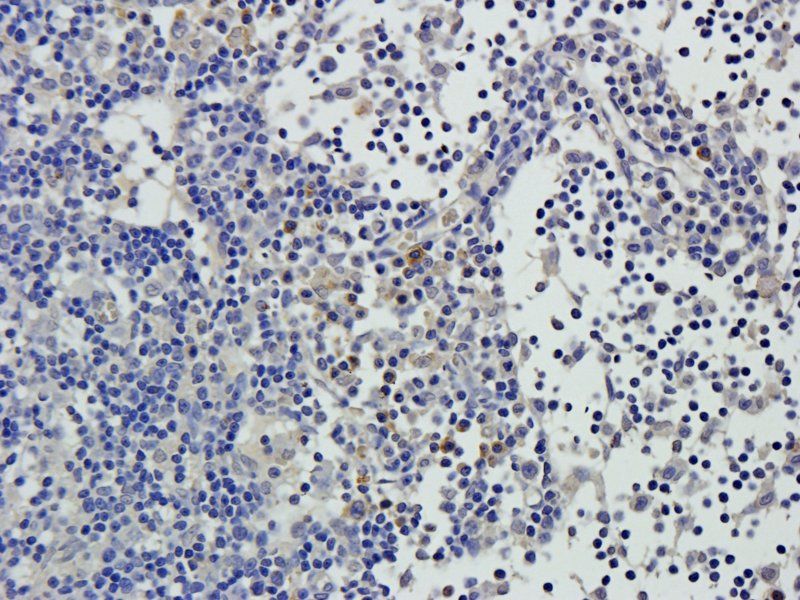 CD105 Rabbit Polyclonal Antibody