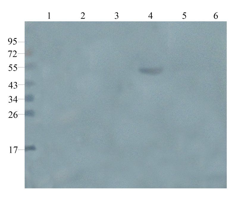 CD105 Rabbit Polyclonal Antibody