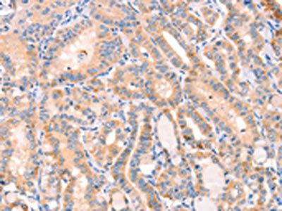 CD109 Antibody