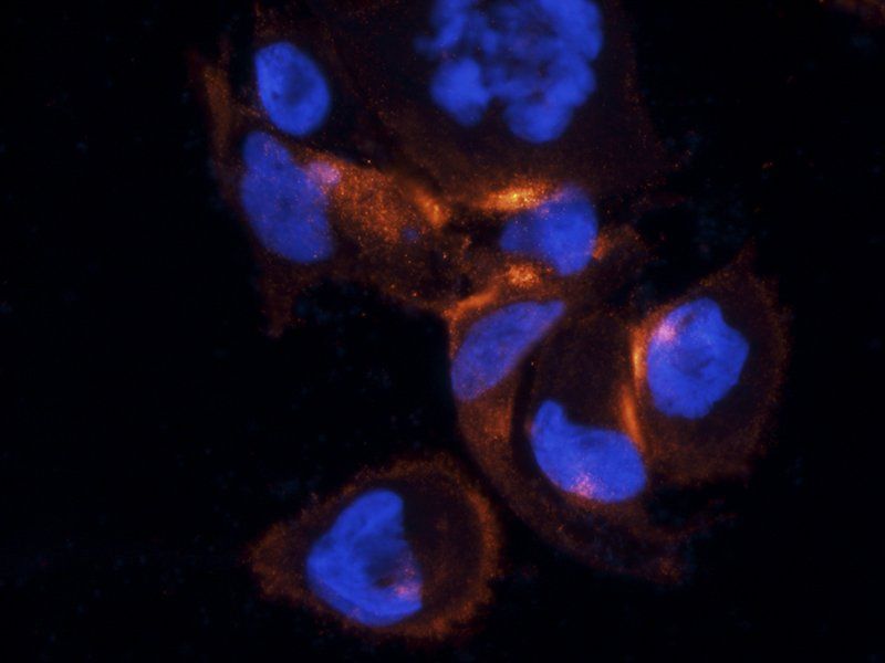 c-Kit Rabbit Polyclonal Antibody