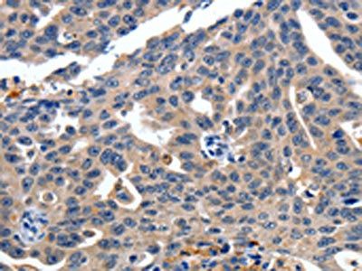 ITGAX Antibody