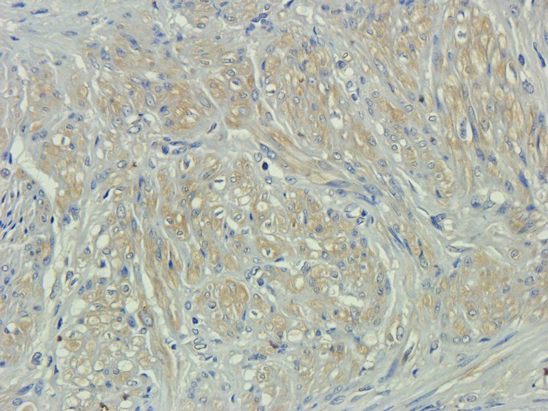 CD133E1 Rabbit Polyclonal Antibody