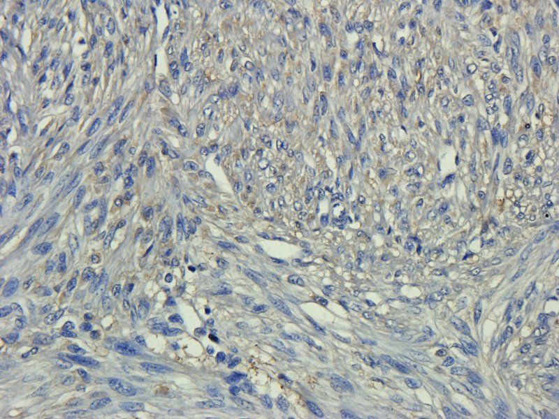 CD133E1 Rabbit Polyclonal Antibody