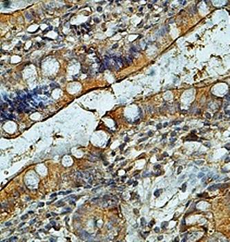 CD13 Rabbit Polyclonal Antibody