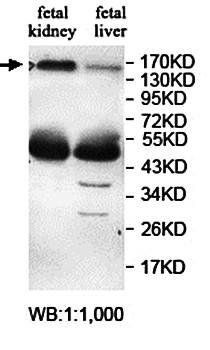 CD13 Rabbit Polyclonal Antibody