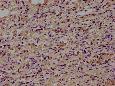 CD14 Monoclonal Antibody