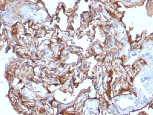 MCAM Antibody