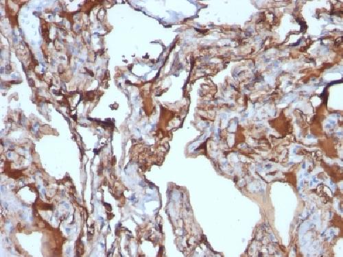 MCAM Antibody