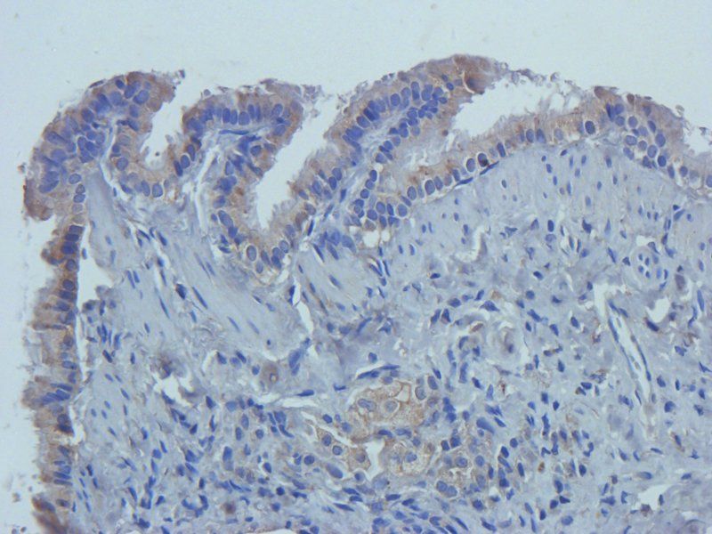 CD14 antibody