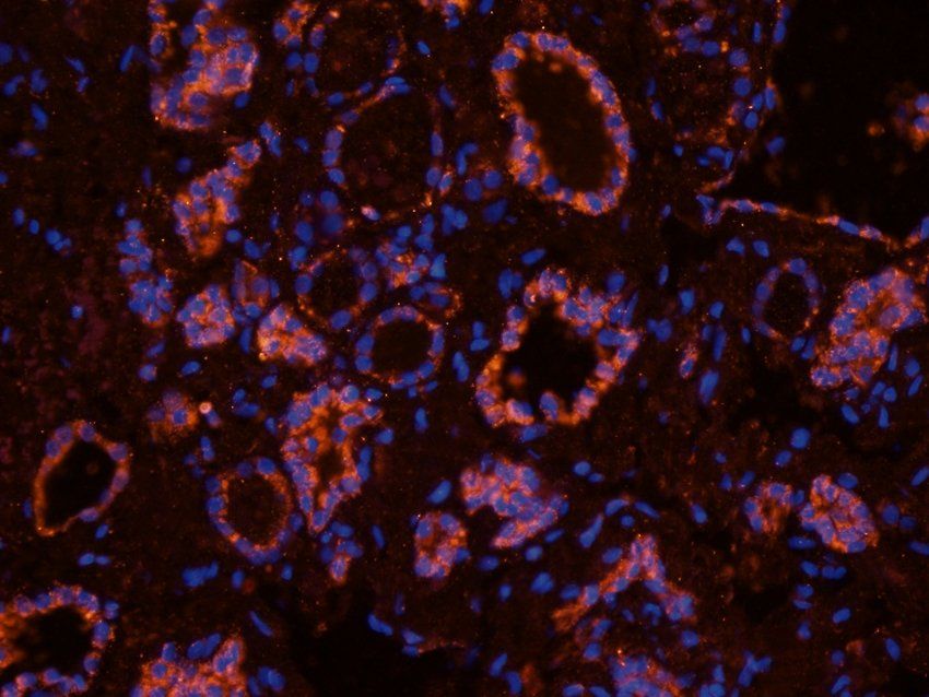 CD170 Rabbit Polyclonal Antibody