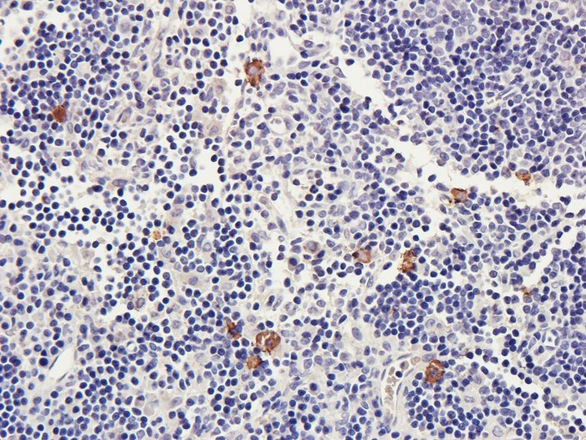 CD170 Rabbit Polyclonal Antibody