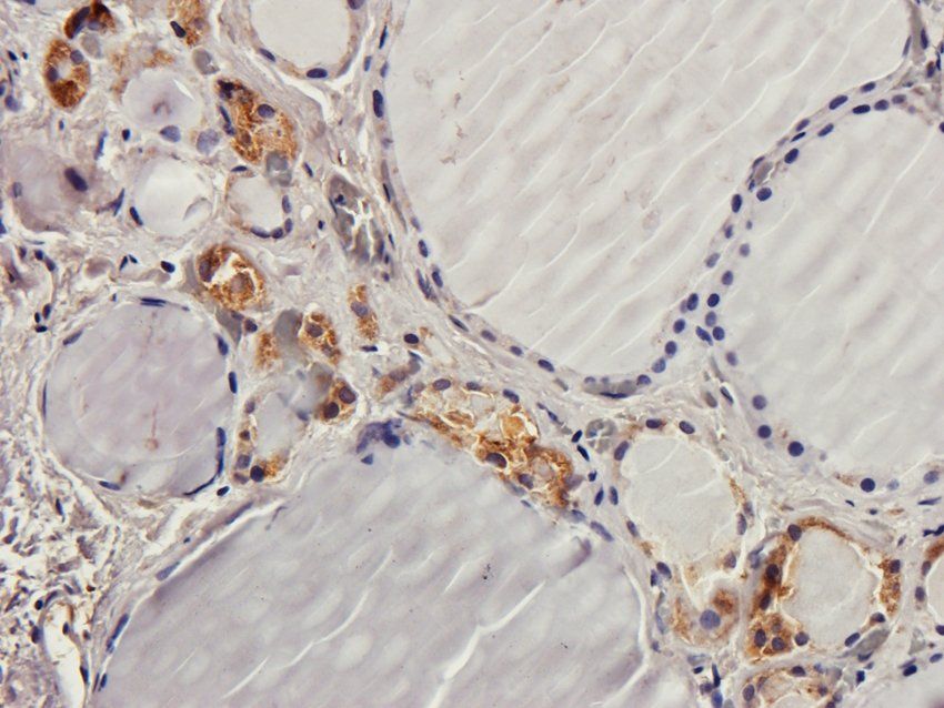 CD170 Rabbit Polyclonal Antibody