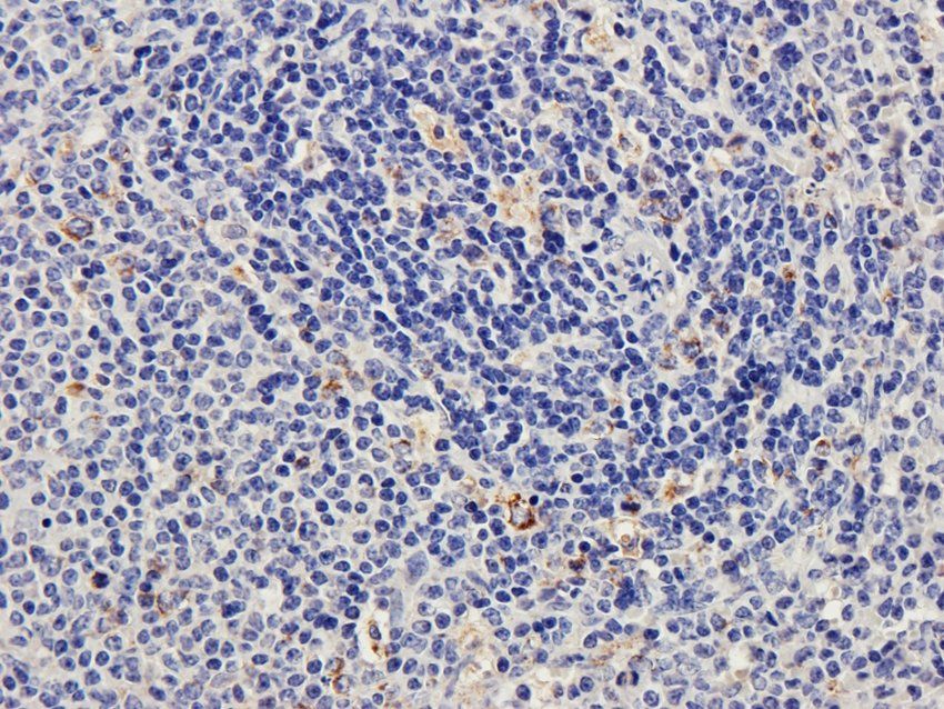 CD170 Rabbit Polyclonal Antibody