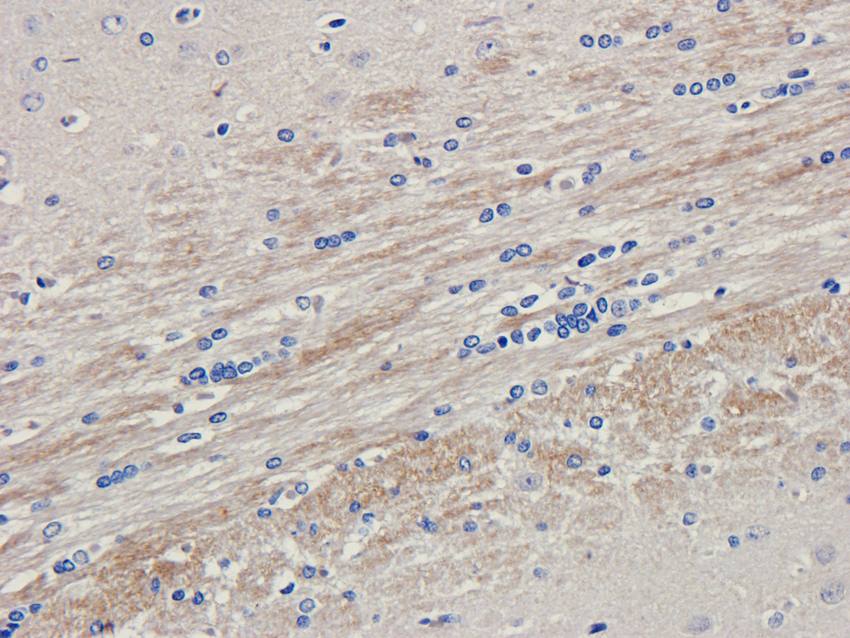 LHCGR antibody