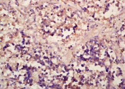 CD20 Rabbit Polyclonal Antibody