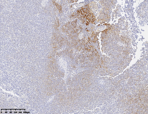 CD21 Antibody