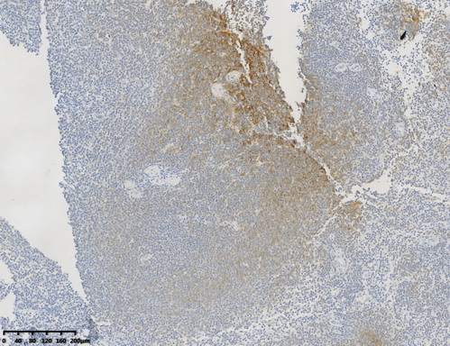CD21 Antibody