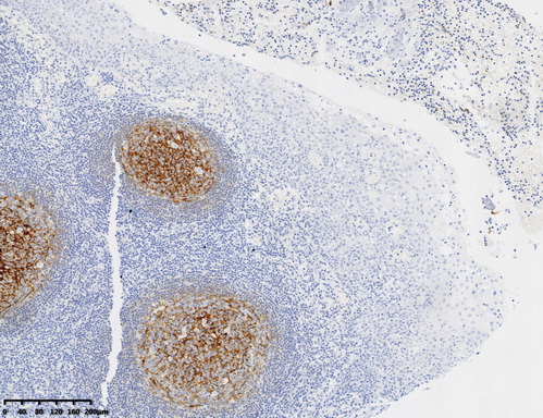 CD21 Antibody