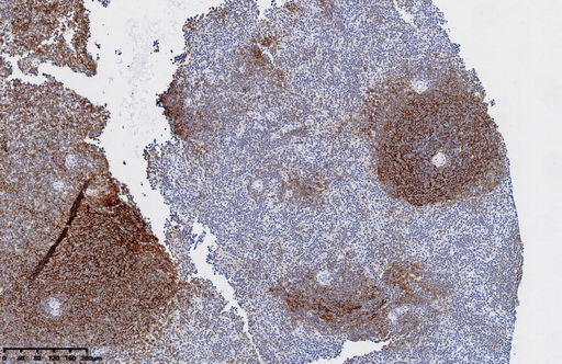 CD21 Antibody