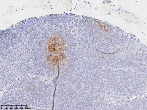 CD21 Antibody
