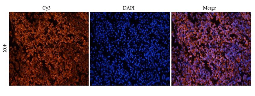 CD25 antibody