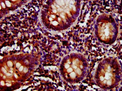 CD27 Antibody