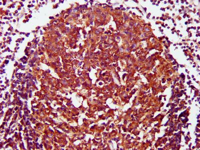 CD27 Antibody