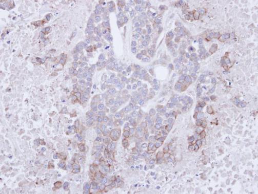CD272 Rabbit Polyclonal Antibody