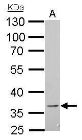 CD272 Rabbit Polyclonal Antibody